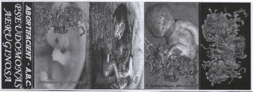 Pseudomonas Aeruginosa : Abortifacient - A, B, C.
